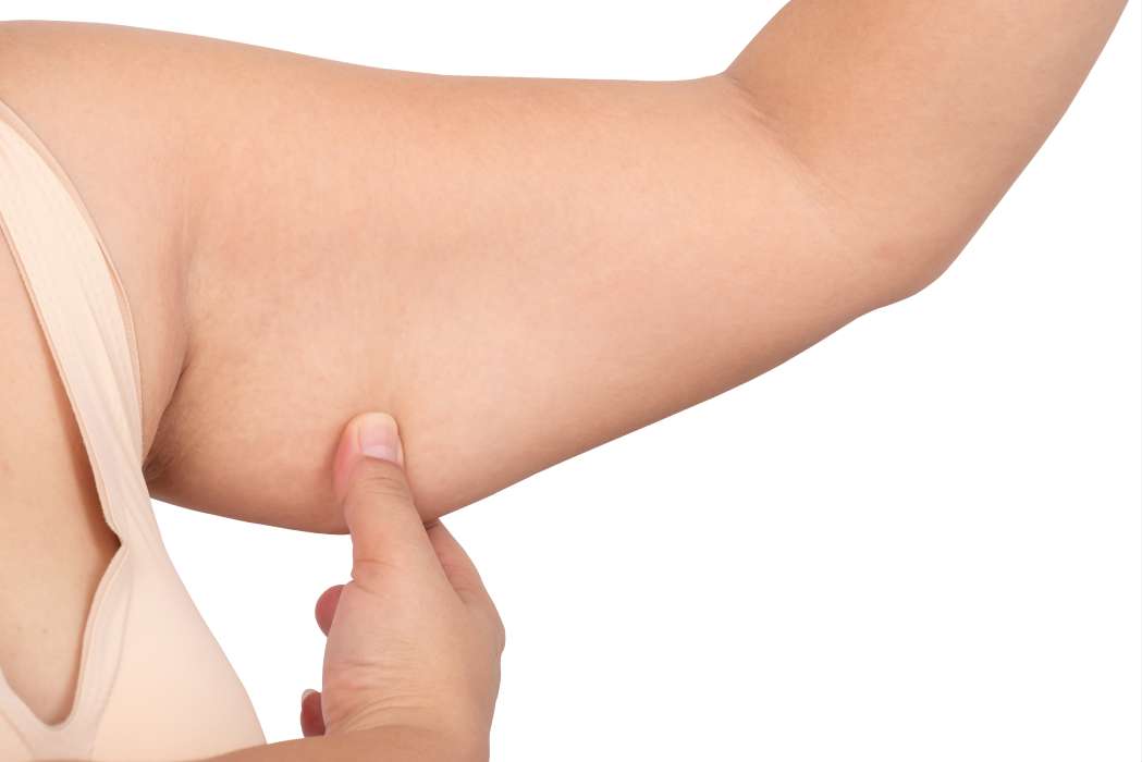 How Can I Reduce My Saggy Arm Skin?