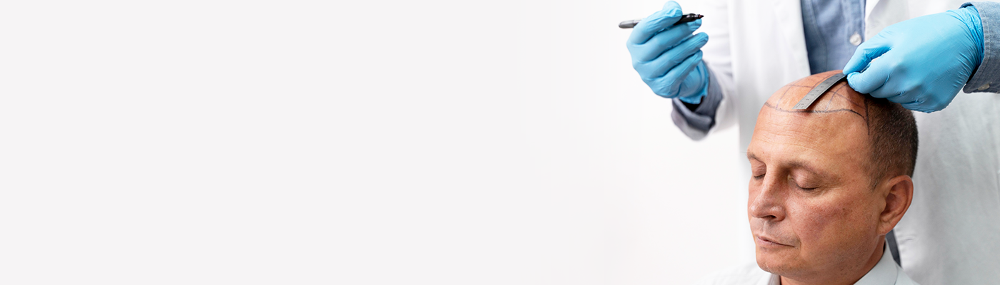 Hair Transplant Clinic