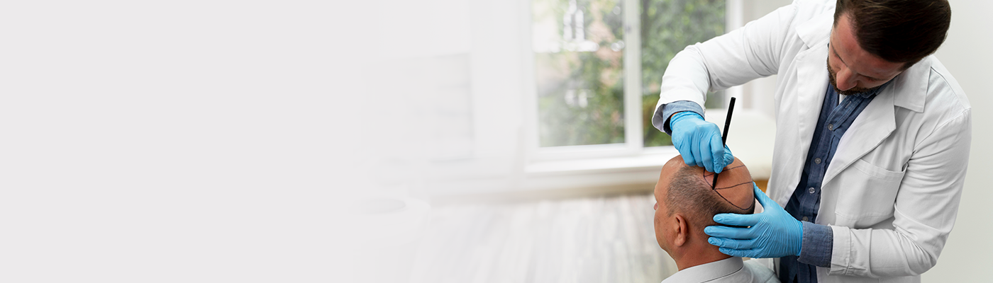 hair loss treatment for men