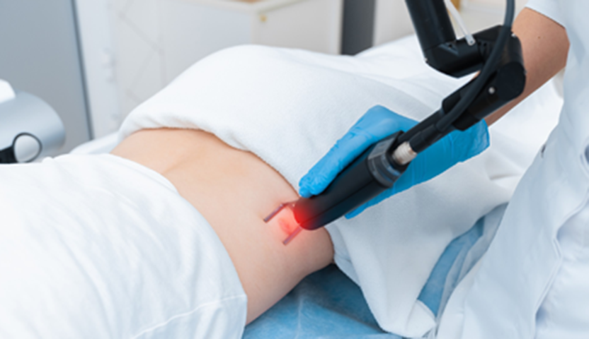 What Is Laser Lipoma Removal and Is It Right for You