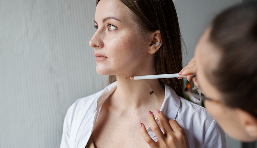 Mole, Wart & Skin Tag Removal: Cost, Procedure & Recovery Explained