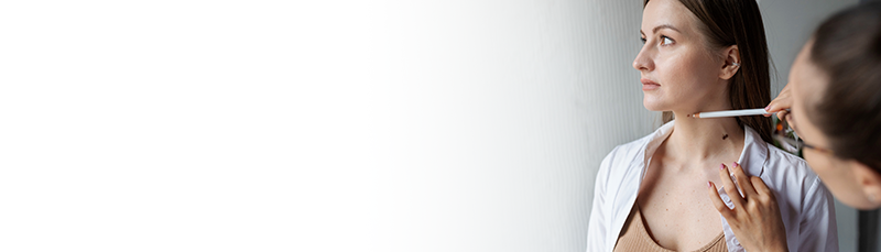 skin tag removal Hyderabad