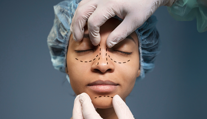 Choosing the Best Cosmetic Surgeon in India: 10 Key Questions to Ask (Especially for Hyderabad Patients)