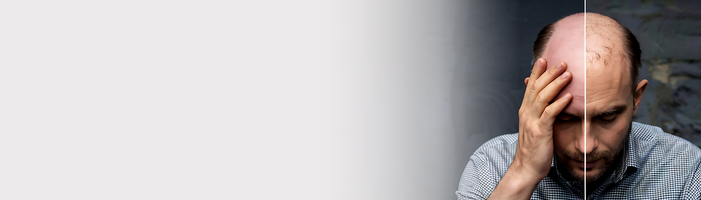 hair fall vs hair loss