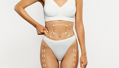 Mommy Makeover Recovery Timeline: Week-by-Week Healing Explained