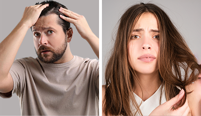 Hair Loss in Men vs Women: Why Treatments Differ