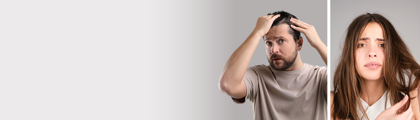 hair loss in men vs women