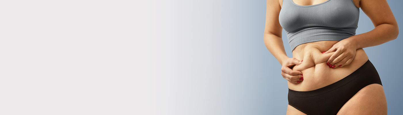 belly fat not going even after exercise