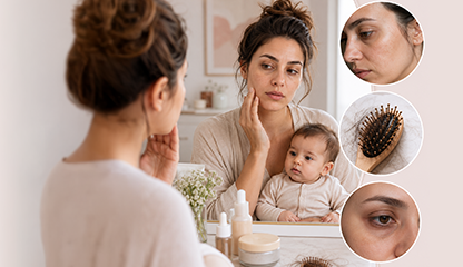 Why Do I Look Older After Having a Baby? Skin, Hair & Facial Changes Explained