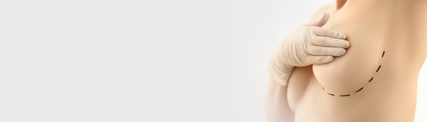 Breast Implant Replacement: When Should Implants Be Changed or Removed?