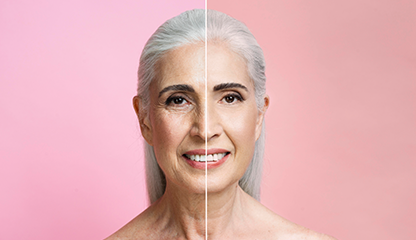 Face Looking Older After Rapid Weight Loss? Why Hollowness and Loose Skin Appear
